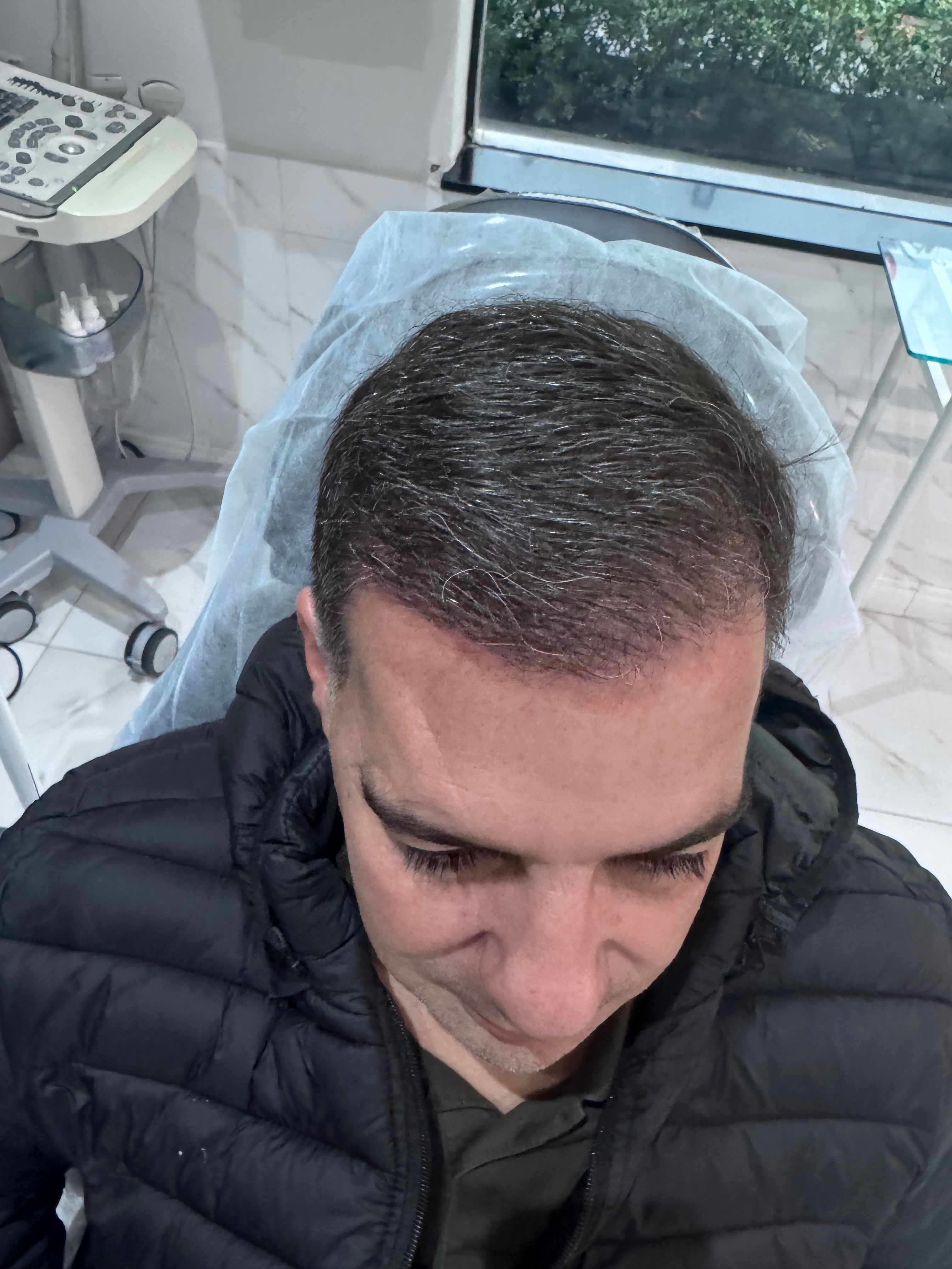 Depois